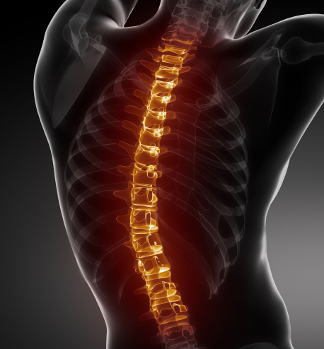 spinal injury